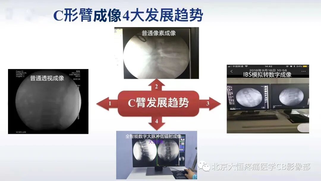 什么是c臂机北京大恒全智能脉冲数字C型臂X射线机性能说明：-上海聚慕医疗器械有限公司