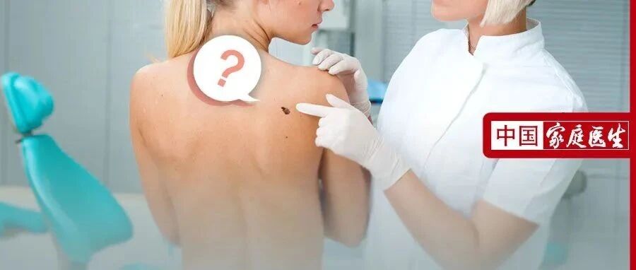 痣长在这个部位，凶多吉少！洗澡时顺便瞄一眼，别等癌上身才后悔