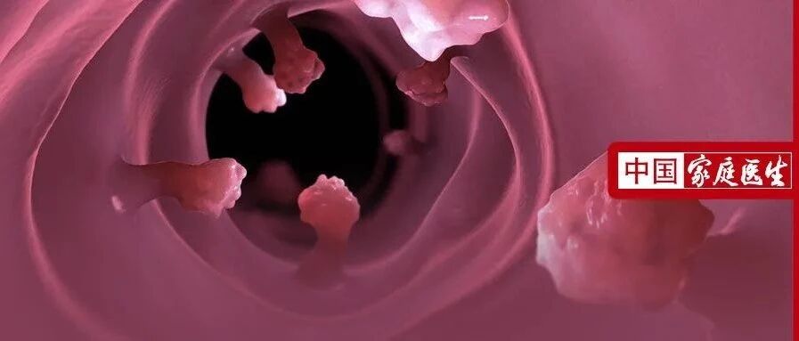 17岁女孩肠道长满息肉，密密麻麻达上万个！这样的息肉、结节是癌前身，体检后别大意