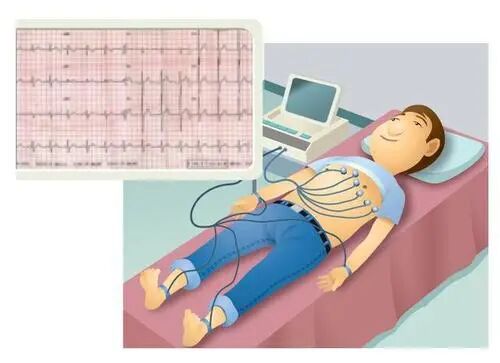 心电图机怎么看【科普】心电图怎么看？点进来带你认识心电图_https://www.jmylbn.com_新闻资讯_第10张