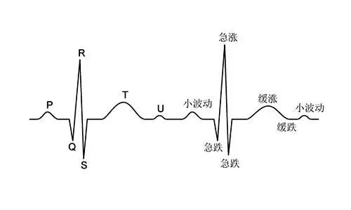 心电图机怎么看【科普】心电图怎么看？点进来带你认识心电图_https://www.jmylbn.com_新闻资讯_第15张