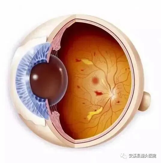 眼底照相有什么用【“视”关重要】眼底一张照，眼病早知道！_https://www.jmylbn.com_新闻资讯_第1张