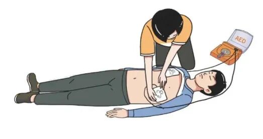 aed电极贴怎么贴急救知识 ｜ 如何正确使用AED？_https://www.jmylbn.com_新闻资讯_第6张