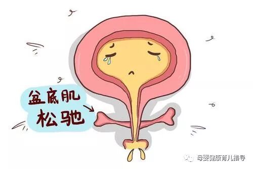 盆底恢复，再不做可能就晚了……