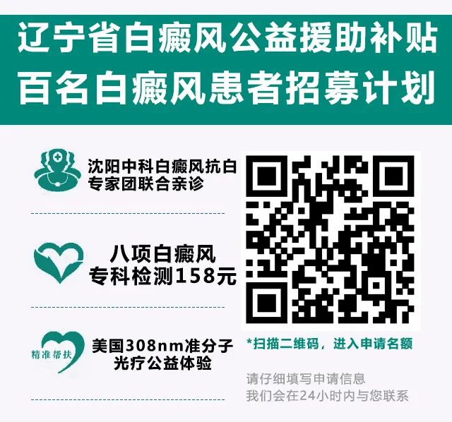 定了！遼寧白癜風患者專項診療援助政策發布！符合條件可立刻申請！ 健康 第14張