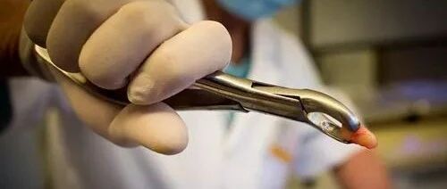 智齿该不该拔？