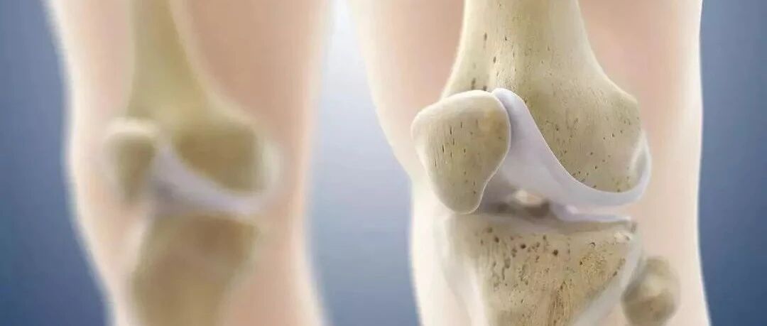 膝关节有积液，该抽吗？