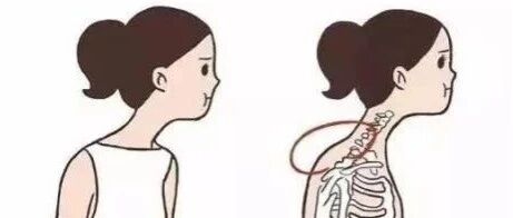 拥有“富贵包”，可不能让你大富大贵！