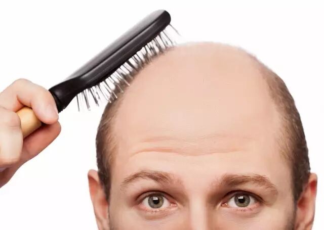 脱发严重怎么办？有一个办法，但你一定不敢用。