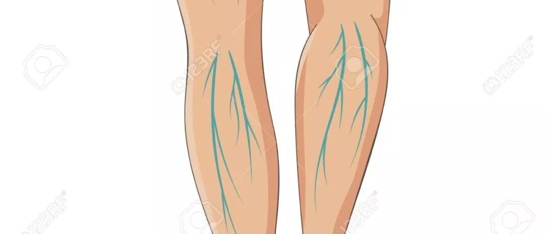 久坐害处多，久站也不行！