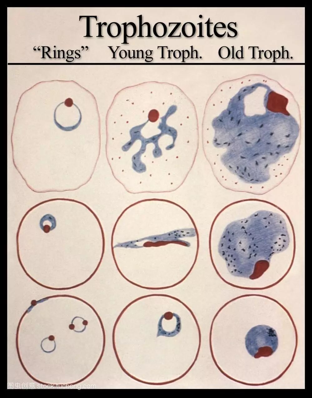 疟疾与痢疾傻傻分不清?