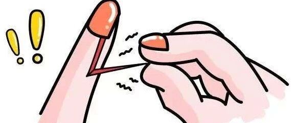 手指长倒刺，撕掉行不行？