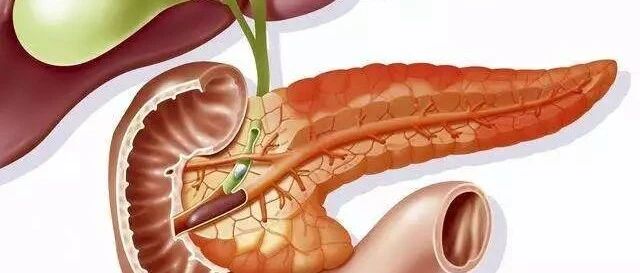 喝多了？吃撑了？谨防急性胰腺炎!