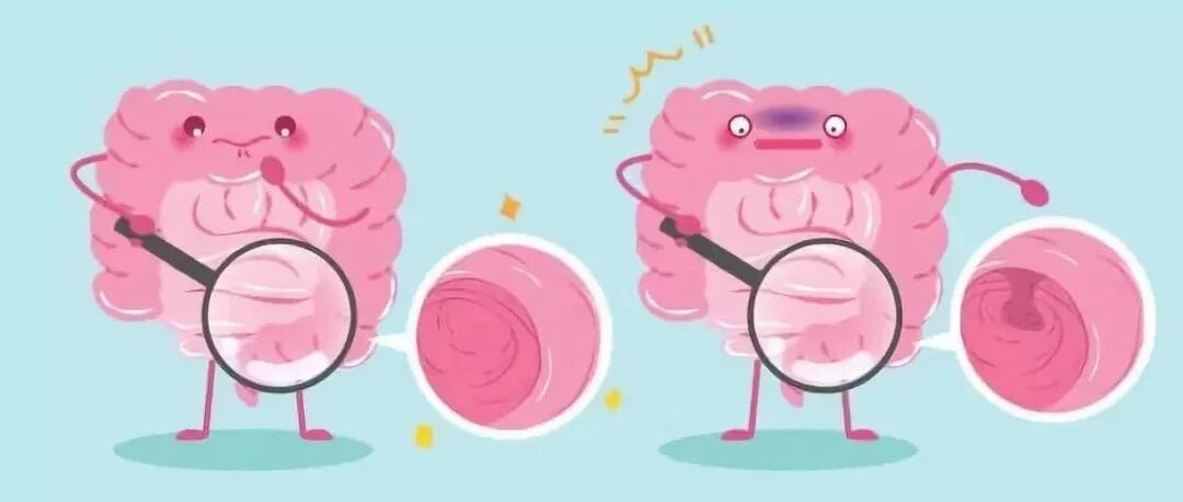 日益年轻化的结肠癌，如何尽早防治？