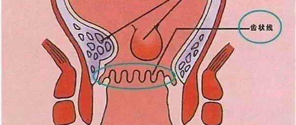 50%的人患这个病，但大多数人不知道改善生活习惯就可以预防