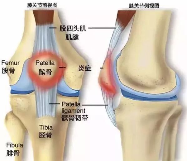 下樓梯膝蓋疼的厲害是怎麼回事？ 健康 第1張