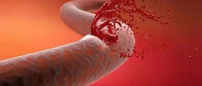 大益茶总裁突发脑溢血去世……这个病该如何预防？