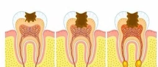 超过六成的婴幼儿、超过九成老年人患有这个病，该怎样预防？