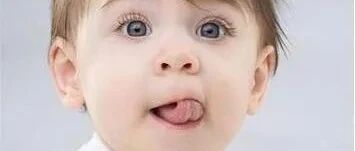 宝宝舌系带过短是否需要治疗？什么年龄接受治疗比较好？