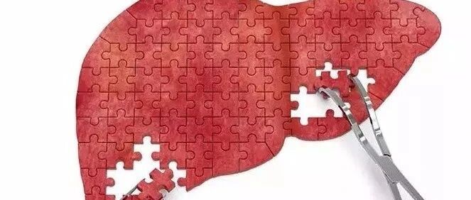 体检发现肝囊肿，该怎么办？