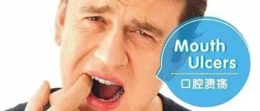 口腔溃疡，我该拿你怎么办？