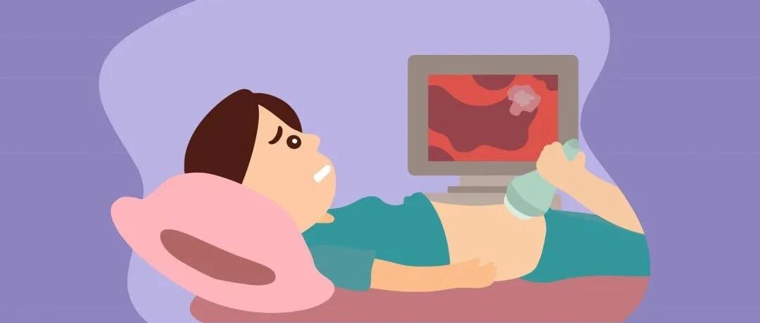 体检发现宫颈息肉该怎么办？需要切除吗？