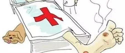 脚总感觉冰冷，脚上皮肤颜色发黑发紫，要警惕这个病！