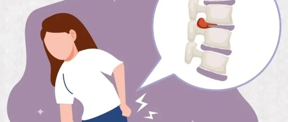 【健康知识】每个腰椎间盘“突出”的人，都和这4件事脱不开干系