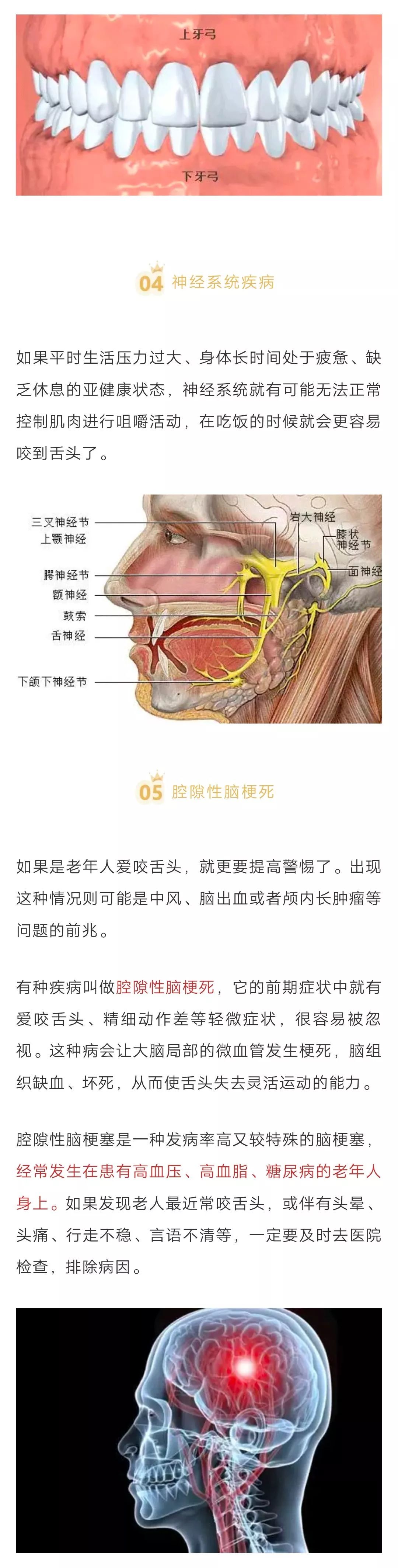 【健康解密】經常咬到舌頭是想吃肉？別以為是小事，可能會要命 健康 第3張