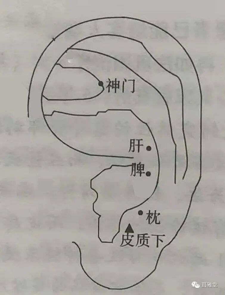 华佗磁疗贴怎么样耳穴放血联合耳穴磁疗对小儿多发性抽动症疗效果显著_https://www.jmylbn.com_新闻资讯_第5张