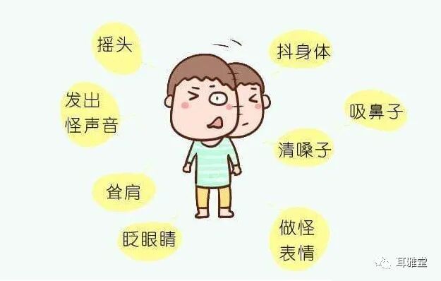 华佗磁疗贴怎么样耳穴放血联合耳穴磁疗对小儿多发性抽动症疗效果显著_https://www.jmylbn.com_新闻资讯_第1张