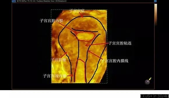 三星彩超怎么样三星WS80A超清5D彩超，助力精准诊断，铸造幸“孕”妈妈_https://www.jmylbn.com_新闻资讯_第3张