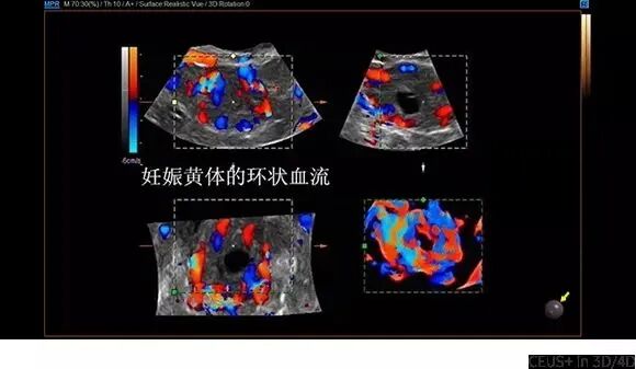 三星彩超怎么样三星WS80A超清5D彩超，助力精准诊断，铸造幸“孕”妈妈_https://www.jmylbn.com_新闻资讯_第4张