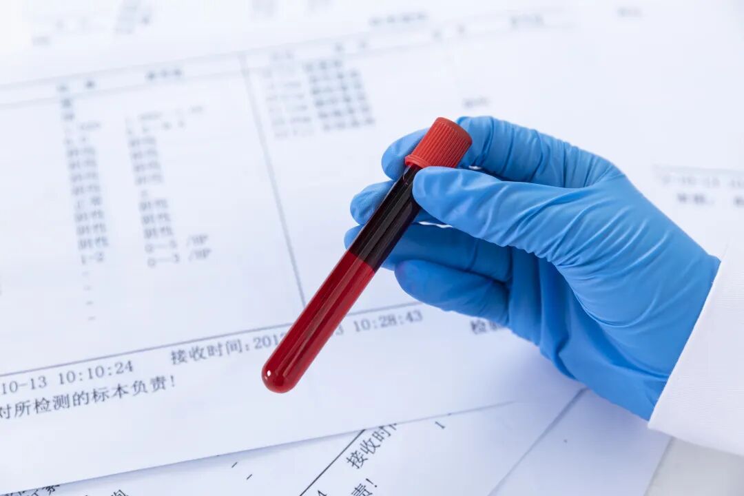 为什么查全自动血细胞抽血检查有哪些项目，能查到什么？_https://www.jmylbn.com_新闻资讯_第2张