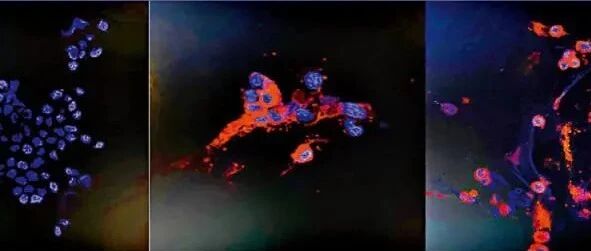 香港成功培养奥密克戎变异毒株，将与内地协商研发疫苗