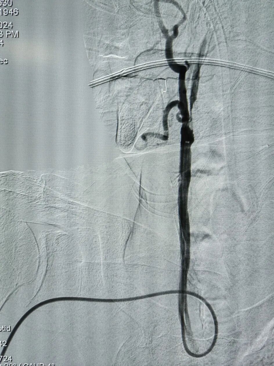 什么叫桡鞘畅疗·第十五期｜畅医达 5F 0.072