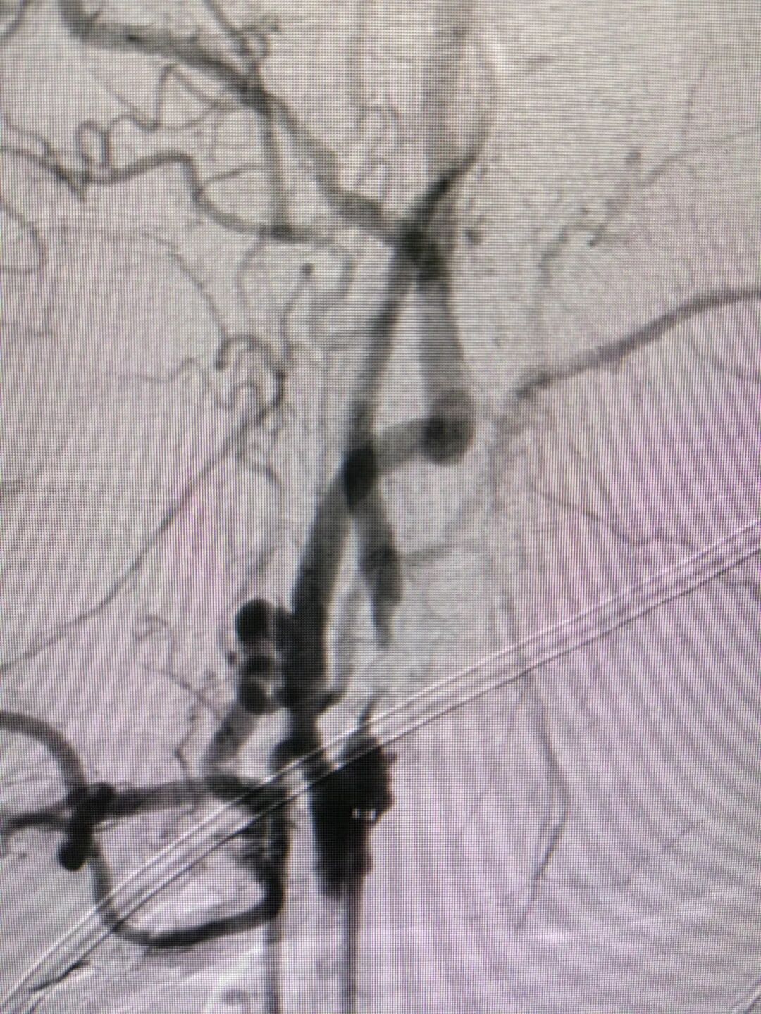 什么叫桡鞘畅疗·第十五期｜畅医达 5F 0.072