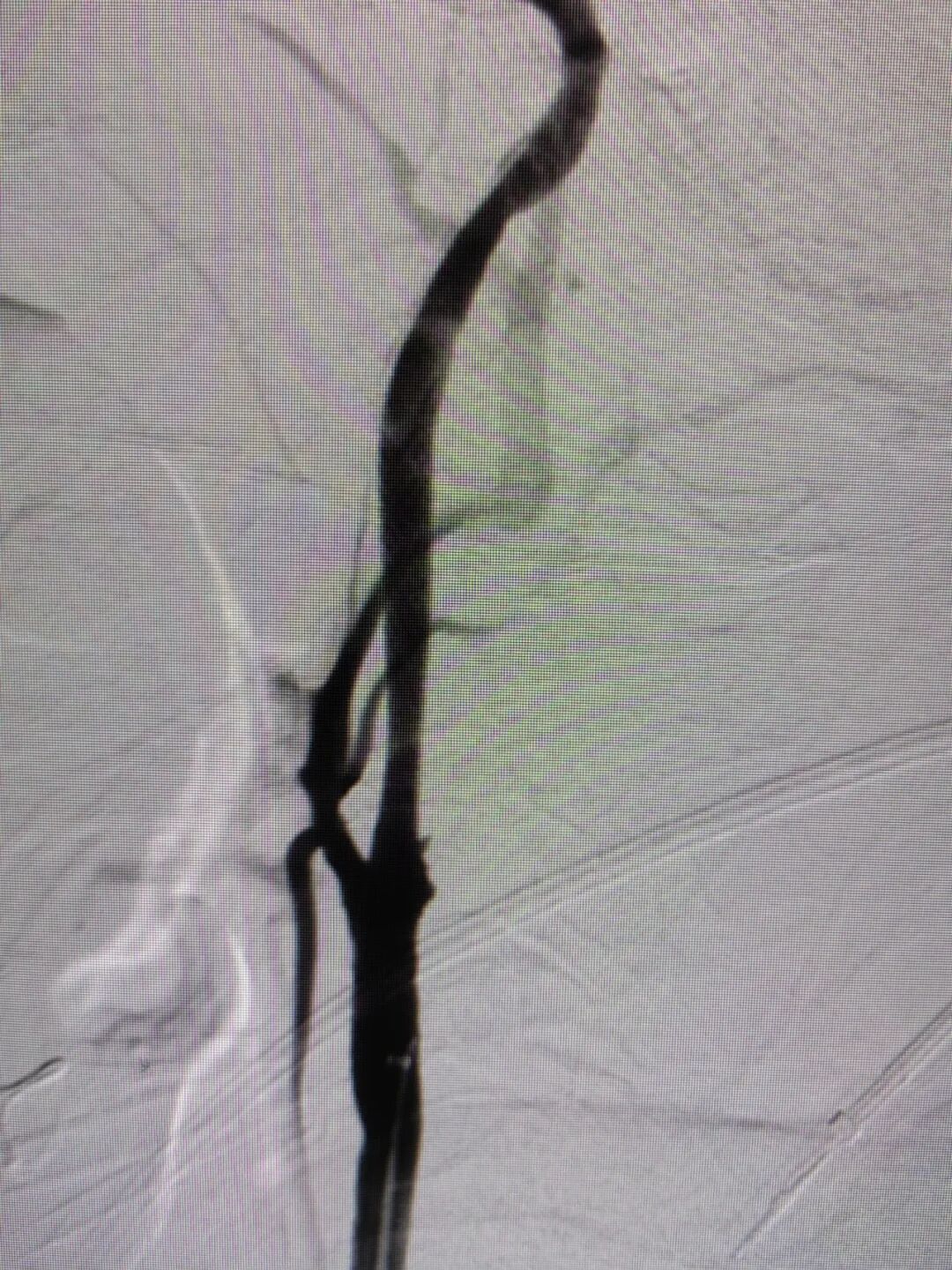 什么叫桡鞘畅疗·第十五期｜畅医达 5F 0.072