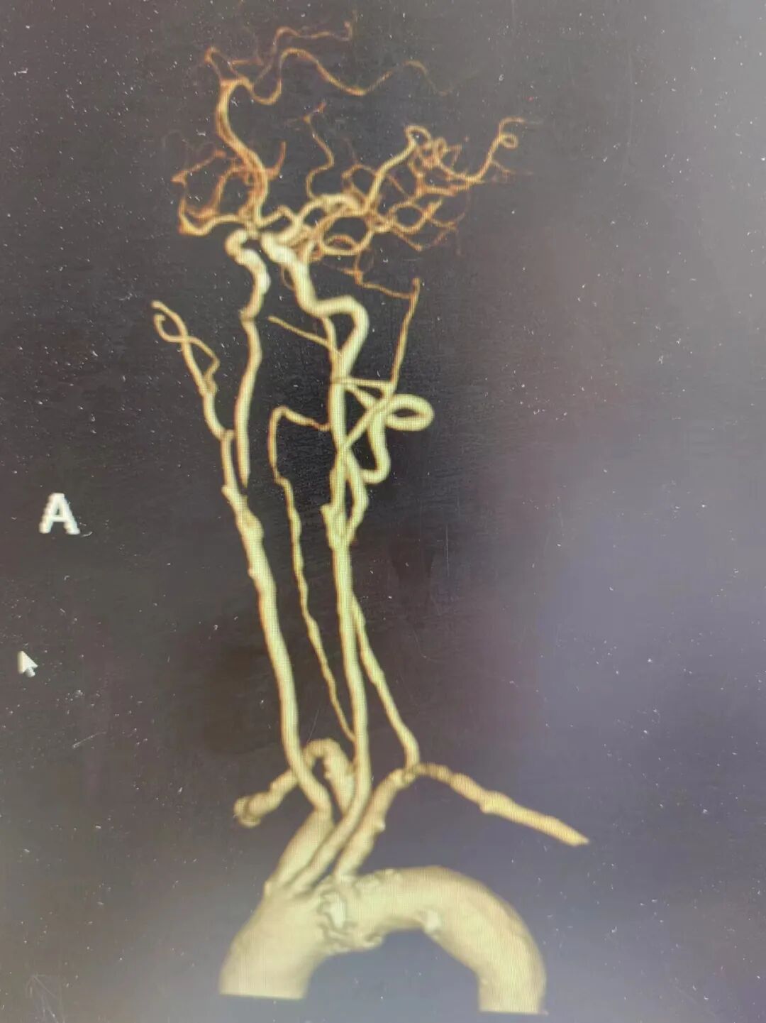 什么叫桡鞘畅疗·第十五期｜畅医达 5F 0.072
