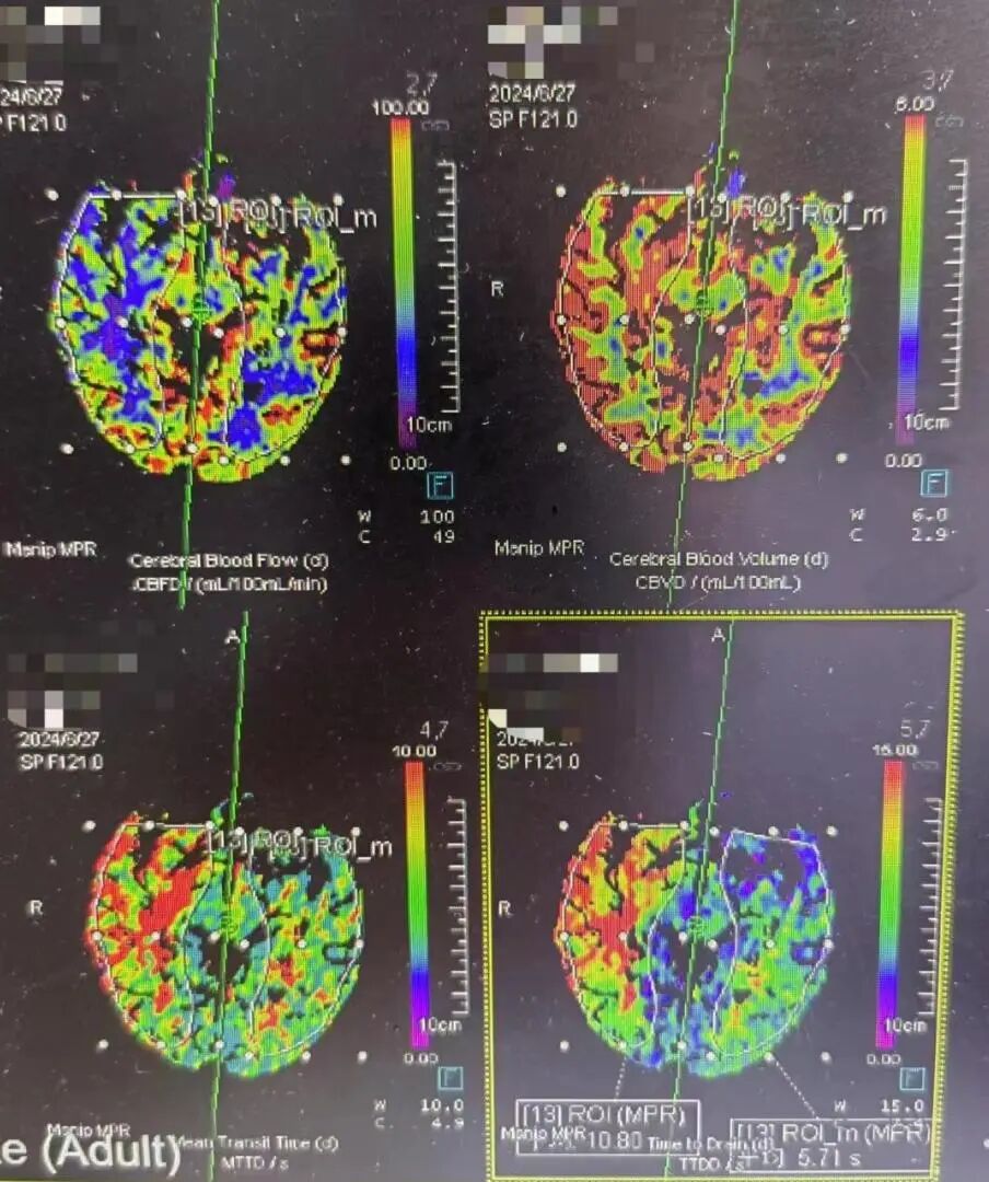 什么叫桡鞘畅疗·第十五期｜畅医达 5F 0.072