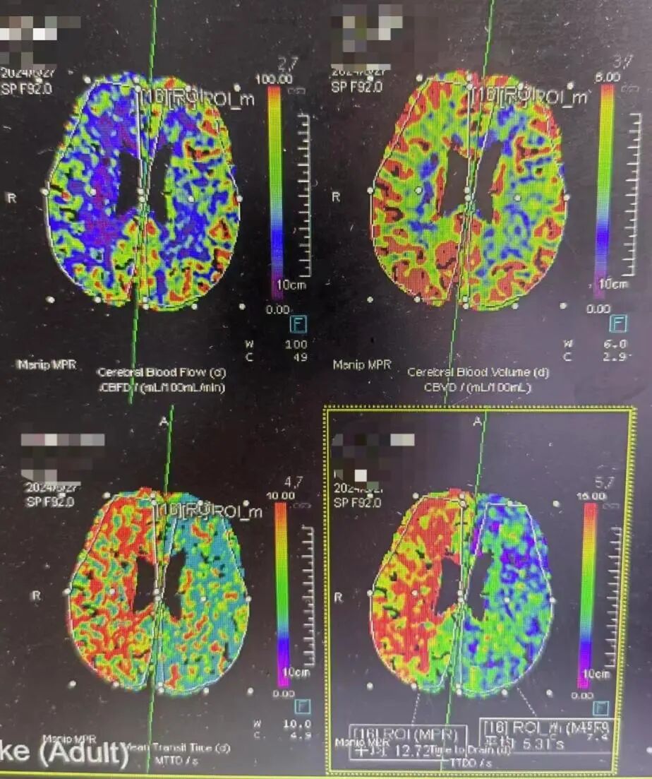 什么叫桡鞘畅疗·第十五期｜畅医达 5F 0.072