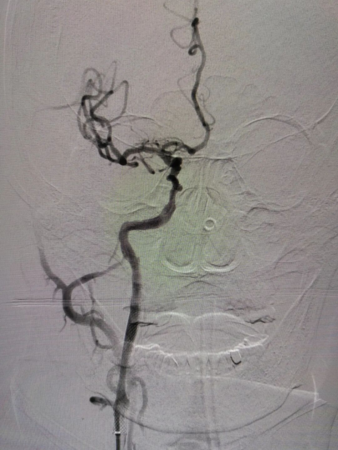 什么叫桡鞘畅疗·第十五期｜畅医达 5F 0.072