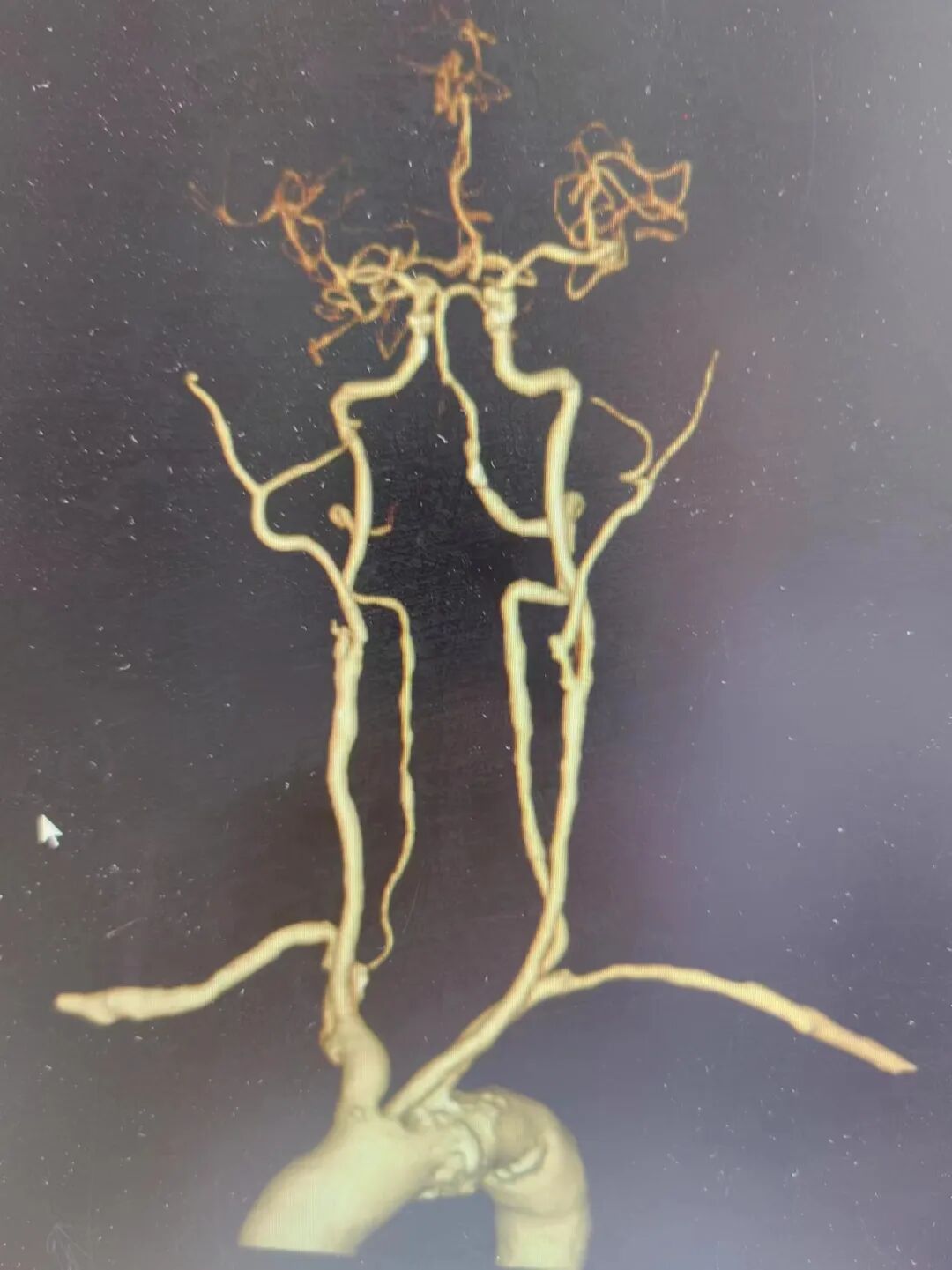 什么叫桡鞘畅疗·第十五期｜畅医达 5F 0.072