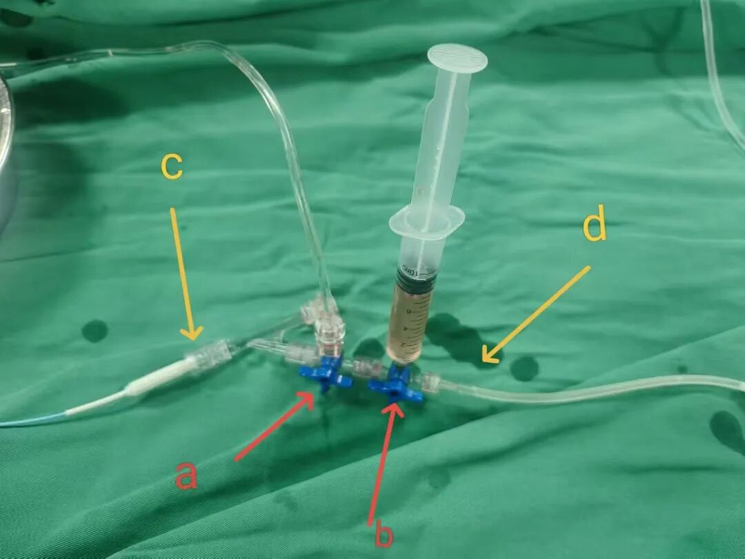 泥鳅导丝怎么用卒中1分钟｜脑血管造影术中常用材料（一）_https://www.jmylbn.com_新闻资讯_第8张