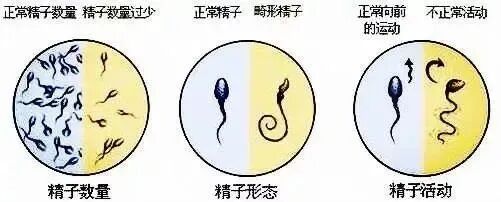 ​试管知识 | 哪些精子问题会影响胚胎质量?