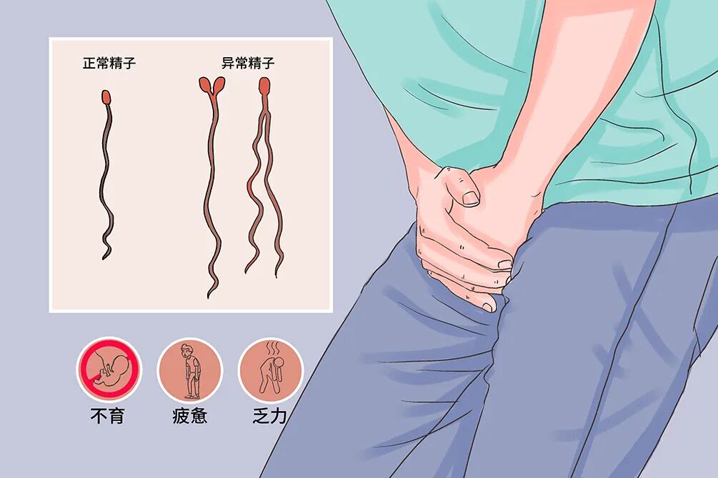 重视男性生育力，别让“小蝌蚪”扯后腿！