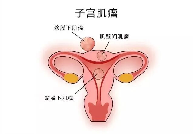为什么越来越多的人不孕？逃不出这几个因素！