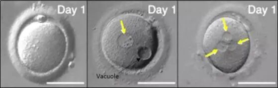 告别「试纸达人」，试管移植后hCG验孕新攻略！！