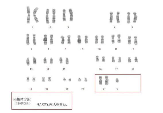有些男性的不育是基因的问题！