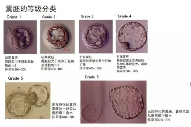 胚胎之间的“拼搏”！到底该不该养囊?
